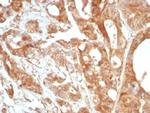 Podoplanin (PDPN) (Lymphatic Endothelial and Mesothelial Marker) Recombinant Rabbit Monoclonal Antibody (PDPN/8875R)