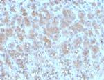 Periostin (POSTN) Monoclonal Antibody (POSTN/3502)