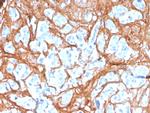 Periostin (POSTN) Antibody in Immunohistochemistry (Paraffin) (IHC (P))