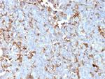 Periostin (POSTN) Antibody in Immunohistochemistry (Paraffin) (IHC (P))