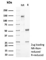 Periostin (POSTN) Antibody in SDS-PAGE (SDS-PAGE)
