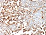 Periostin (POSTN) Antibody in Immunohistochemistry (Paraffin) (IHC (P))