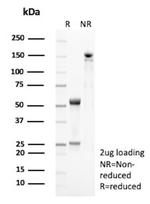 Periostin (POSTN) Antibody in SDS-PAGE (SDS-PAGE)