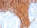 Periostin (POSTN) Recombinant Rabbit Monoclonal Antibody (POSTN/8523R)