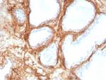 Periostin (POSTN) Recombinant Rabbit Monoclonal Antibody (POSTN/8951R)