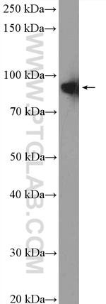 XAB2 Antibody in Western Blot (WB)