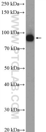 XAB2 Antibody in Western Blot (WB)
