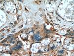 Placental Growth Factor Antibody in Immunohistochemistry (Paraffin) (IHC (P))