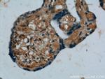 Placental Growth Factor Antibody in Immunohistochemistry (Paraffin) (IHC (P))