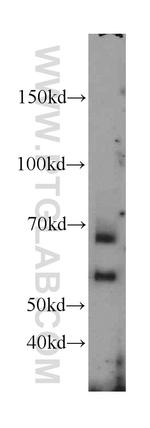 CDC25B Antibody in Western Blot (WB)