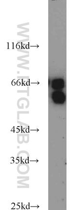CDC25B Antibody in Western Blot (WB)