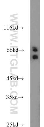 CDC25B Antibody in Western Blot (WB)