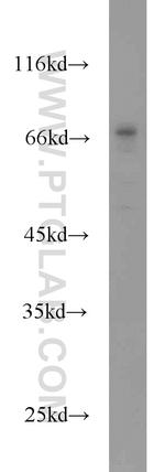 CDC25B Antibody in Western Blot (WB)