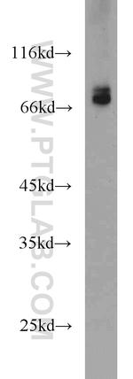 CDC25B Antibody in Western Blot (WB)