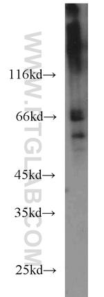 CDC25B Antibody in Western Blot (WB)