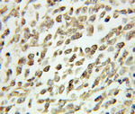 CDC25B Antibody in Immunohistochemistry (Paraffin) (IHC (P))