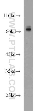 CDC25B Antibody in Western Blot (WB)