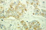 ARPC1B Antibody in Immunohistochemistry (Paraffin) (IHC (P))