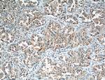 HIF1AN Antibody in Immunohistochemistry (Paraffin) (IHC (P))