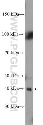 HIF1AN Antibody in Western Blot (WB)