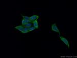 TOR3A Antibody in Immunocytochemistry (ICC/IF)