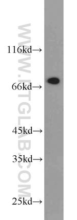 DPP3 Antibody in Western Blot (WB)