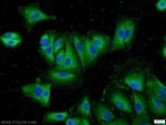 Inhibin beta A Antibody in Immunocytochemistry (ICC/IF)