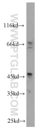 Inhibin beta A Antibody in Western Blot (WB)