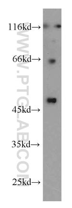 Inhibin beta A Antibody in Western Blot (WB)