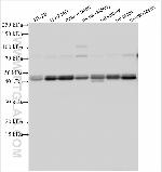 ACTRT3/ARPM1 Antibody in Western Blot (WB)
