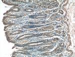 Ajuba Antibody in Immunohistochemistry (Paraffin) (IHC (P))
