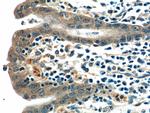 Ajuba Antibody in Immunohistochemistry (Paraffin) (IHC (P))
