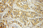 Ajuba Antibody in Immunohistochemistry (Paraffin) (IHC (P))