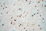 Hsc70 Antibody in Immunohistochemistry (Paraffin) (IHC (P))