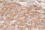 DENR Antibody in Immunohistochemistry (Paraffin) (IHC (P))