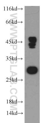 DENR Antibody in Western Blot (WB)