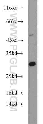 DENR Antibody in Western Blot (WB)