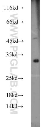 DENR Antibody in Western Blot (WB)