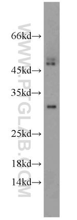 DENR Antibody in Western Blot (WB)