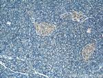 FBXW4 Antibody in Immunohistochemistry (Paraffin) (IHC (P))