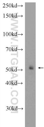 FBXW4 Antibody in Western Blot (WB)