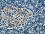 FBXW4 Antibody in Immunohistochemistry (Paraffin) (IHC (P))