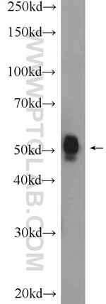 FBXW4 Antibody in Western Blot (WB)