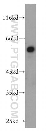 AHCYL1 Antibody in Western Blot (WB)