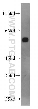 AHCYL1 Antibody in Western Blot (WB)