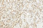 HNRPDL Antibody in Immunohistochemistry (Paraffin) (IHC (P))