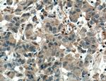 SULT1C2 Antibody in Immunohistochemistry (Paraffin) (IHC (P))