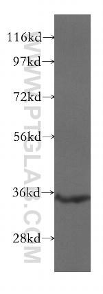 SULT1C2 Antibody in Western Blot (WB)