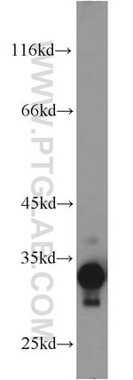 SULT1C2 Antibody in Western Blot (WB)