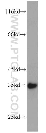 SULT1C2 Antibody in Western Blot (WB)